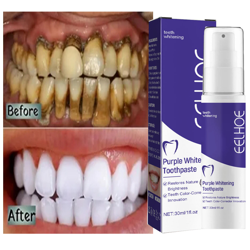 Teeth Whitening Korea - 1pcs Teeth Cleansing Whitening Toothpaste Whiten