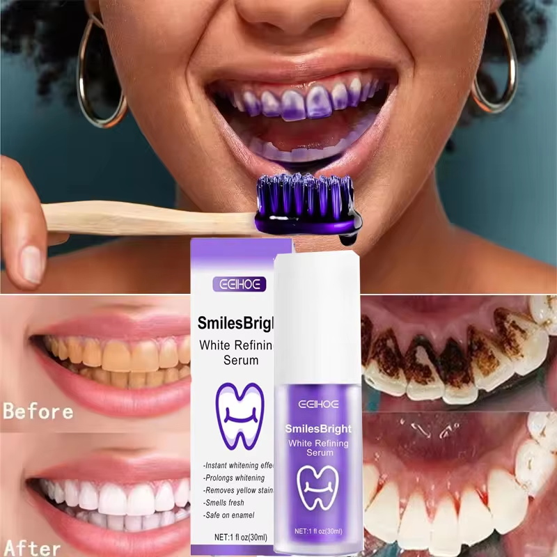 Teeth Cleansing Whitening Toot - đánh giá và giá Teeth Whitening Korea