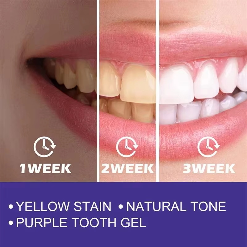 Teeth Cleansing Whitening Toot - đánh giá và giá Teeth Whitening Korea