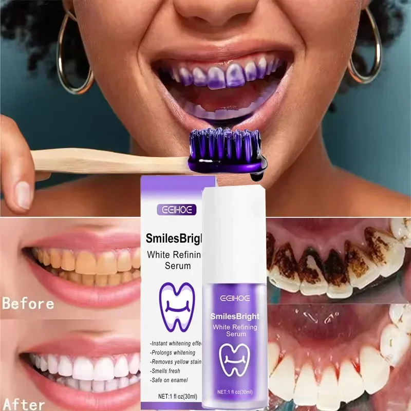 Teeth Cleansing Whitening Toot - đánh giá và giá Teeth Whitening Korea