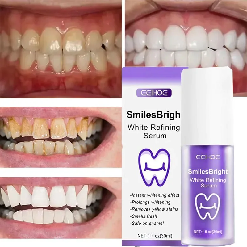 Teeth Cleansing Whitening Toot - đánh giá và giá Teeth Whitening Korea