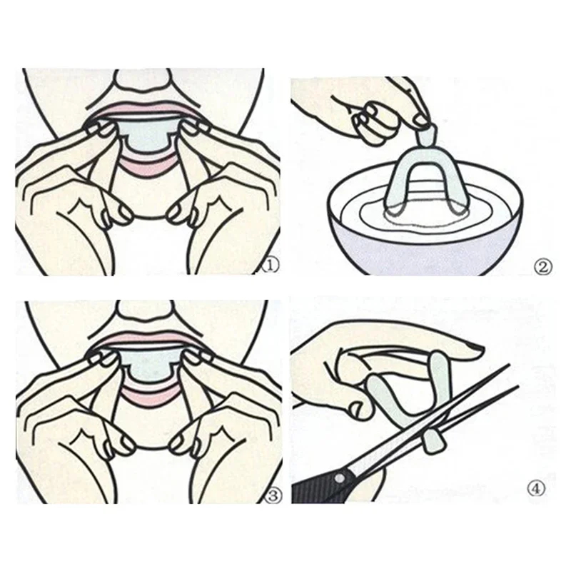 1/2/3/4/5/6Pairs Mouth Guard B - đánh giá và giá Teeth Whitening Gels Used By Dentists
