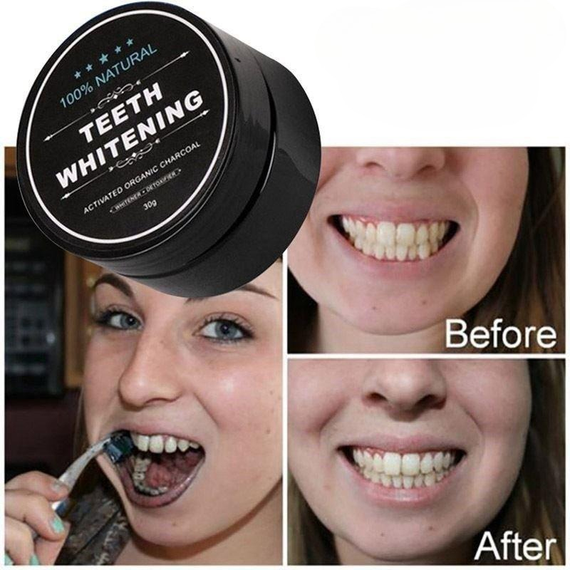 1 Box Activated Charcoal Teeth - đánh giá và giá Teeth Whitening Zimba