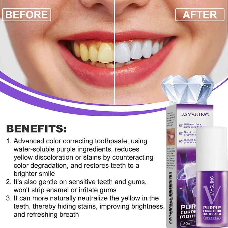 Teeth Cleansing Whitening Toot - đánh giá và giá Teeth Whitening Korea
