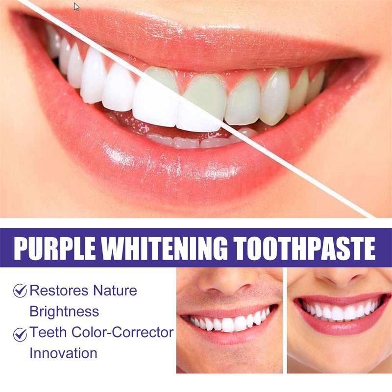 Teeth Cleansing Whitening Toot - đánh giá và giá Teeth Whitening Korea