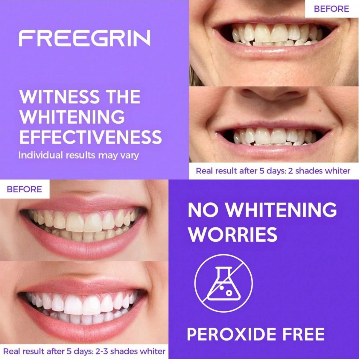 Deluxe Whitening Teeth Sticker - đánh giá và giá Teeth Whitening Remedies